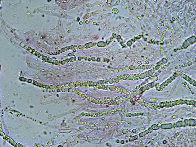 Artomyces gleocystidia x 60 (1)