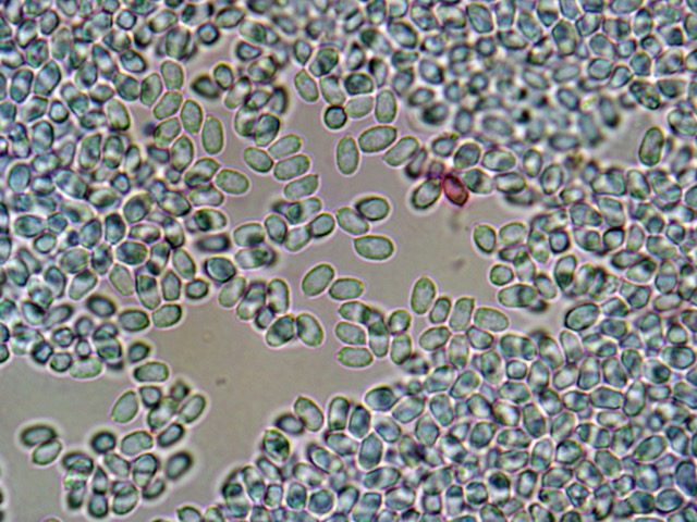 Artomyces spores x 100 2